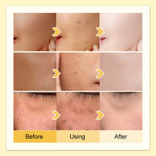 JellyPrim Papaya Exfoliating Gel Facial Removes Dead Skin Reduce Blackheads Whitening Peeling Gel