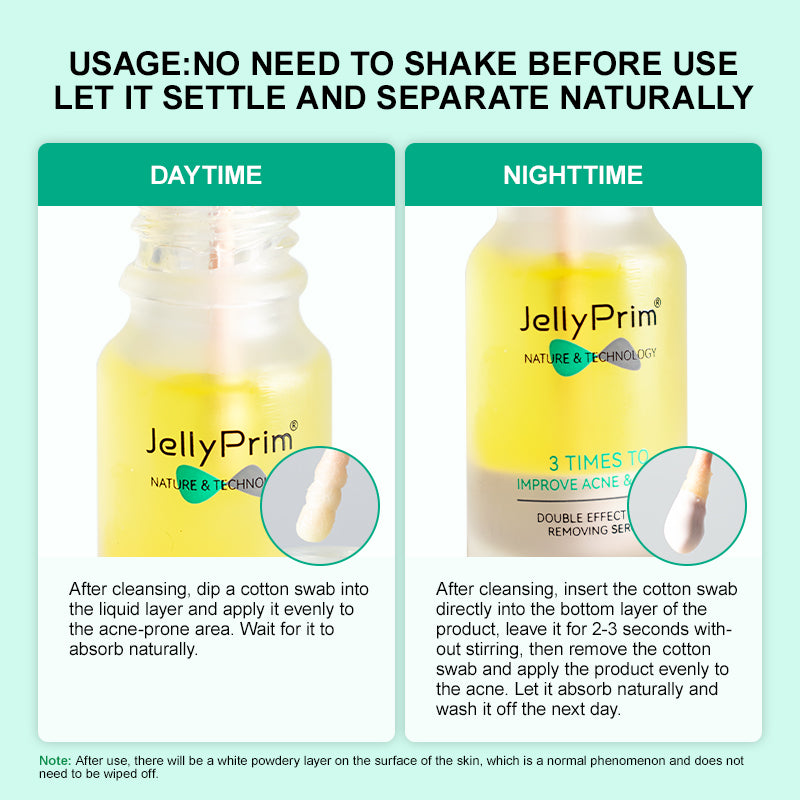 JellyPrim Pimple Acne Spot Treatment Salicylic Acid Acne Drying Lotion   Acne Spot Treatment Care